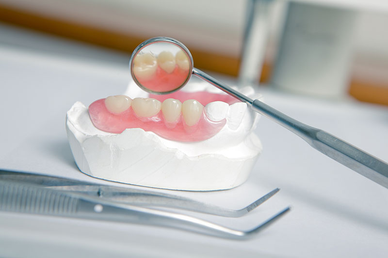 a mold of dentures being examined using a mirror dental tool